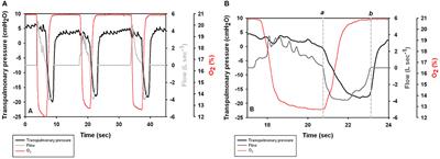 Respiratory Function in Voluntary Participating Patagonia Sea Lions (Otaria flavescens) in Sternal Recumbency